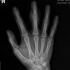 刺客