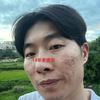 自己操作14年老痘坑_夏琪尔本人