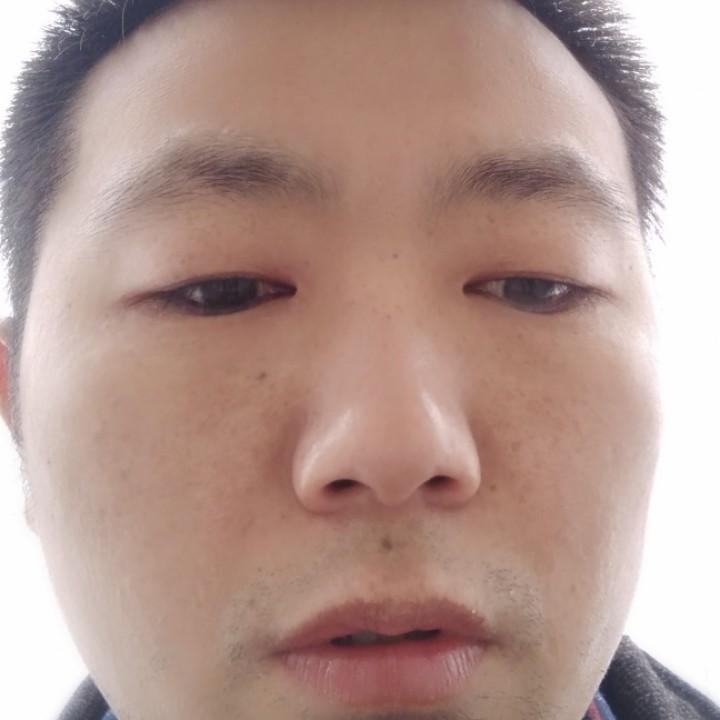平哥