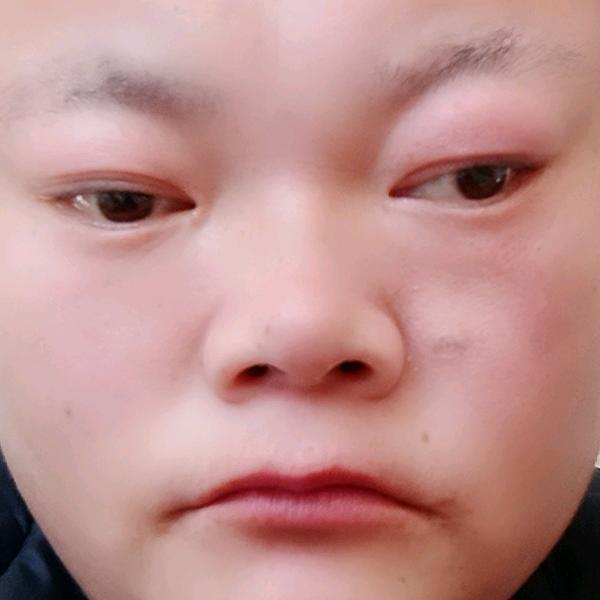2315