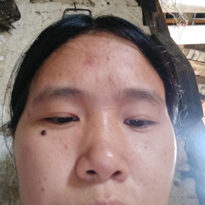 郭月娥
