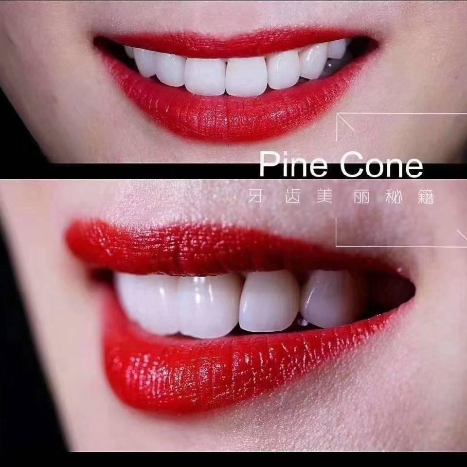 @爱跑步的牙小姐