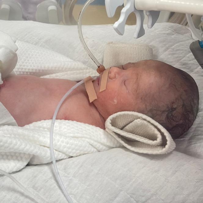 小小圳（早产儿2.8斤）