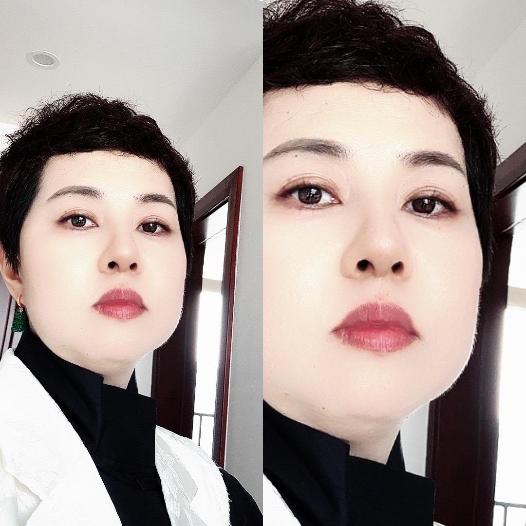 在珠海祛痘的千惠姐姐