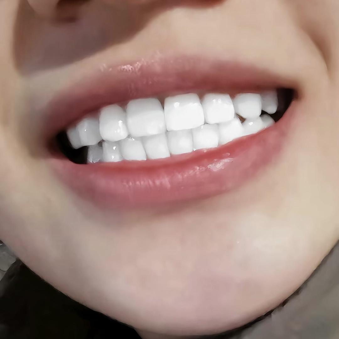 美白牙膏正在直播中