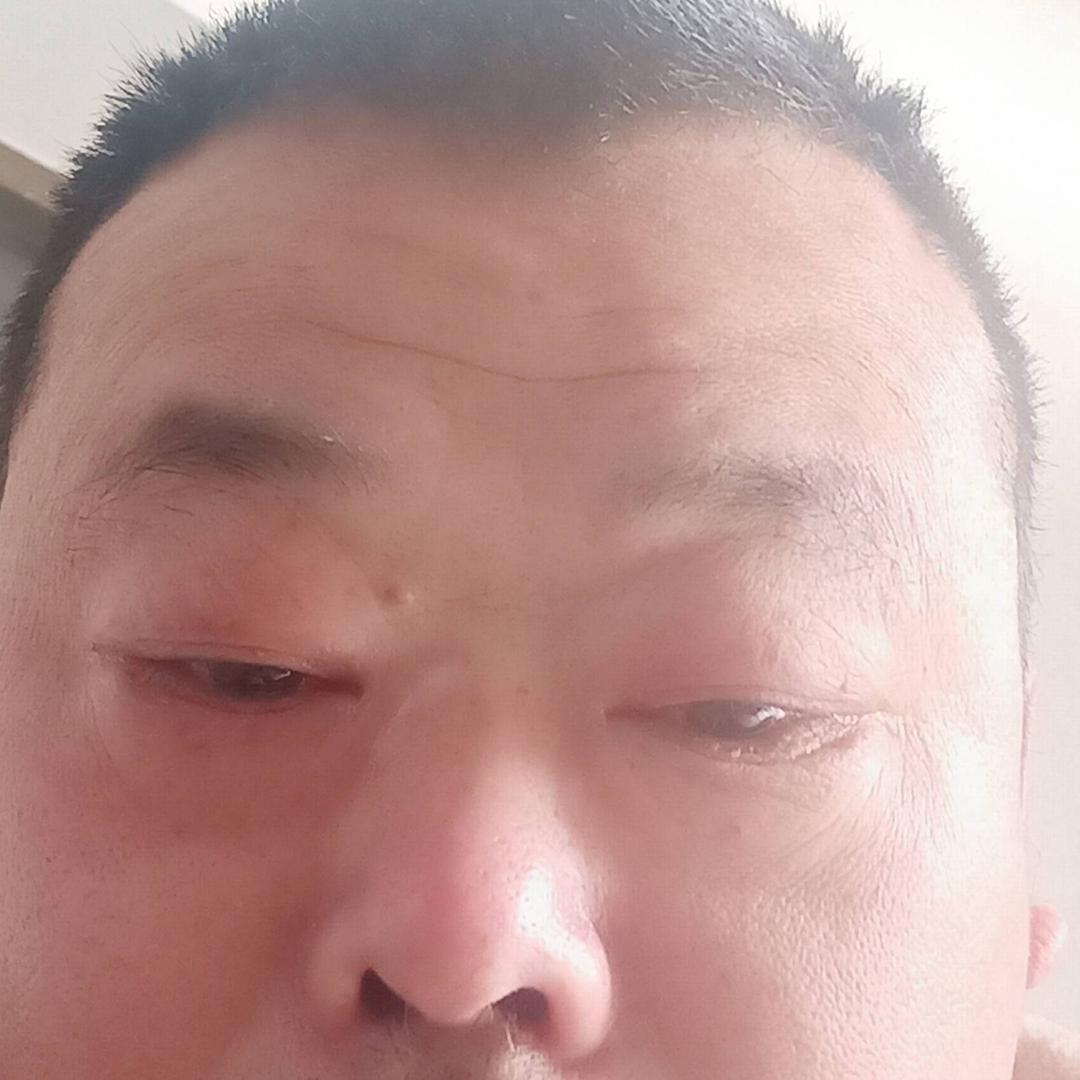 用户黄哥地平收光