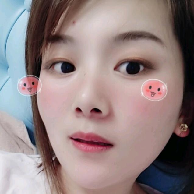 凤姐