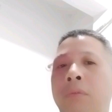 杨哥