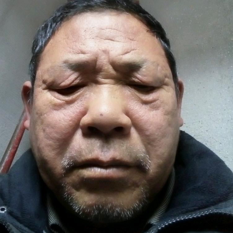 田野