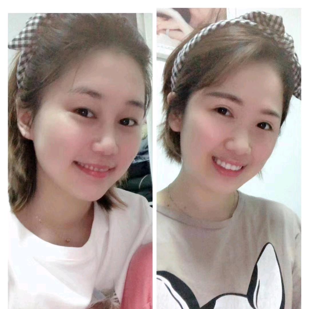 黄丫丫