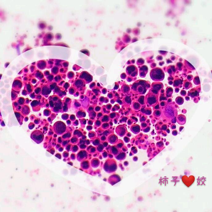 柿子姣໑ຼₒ₂₂୧⍤⃝💞ـــﮩﮩ٨ـ