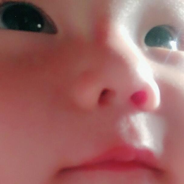 阿呆