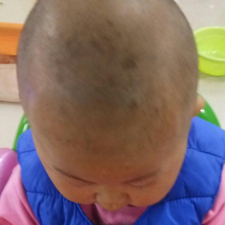 恩哼