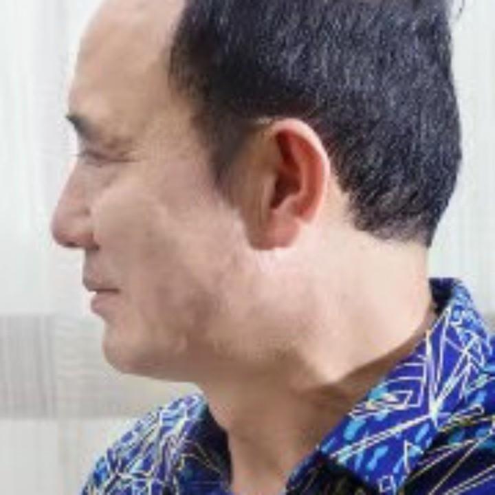 闪电