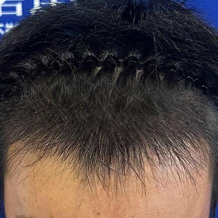 卡皮巴拉（生发版）