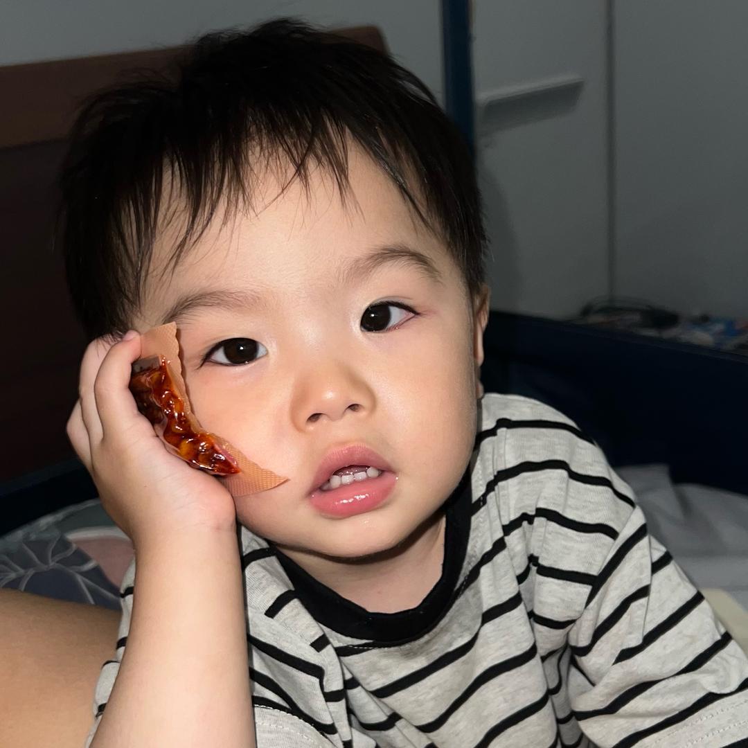 小臭宝