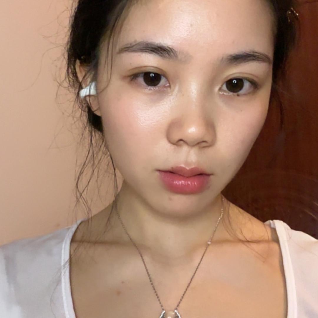 琴子