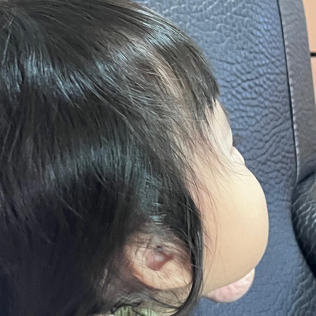 余生
