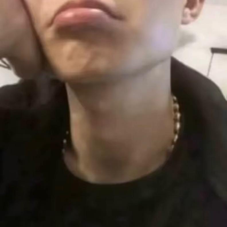 小雨-