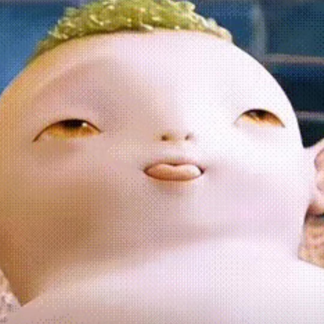 湖疤