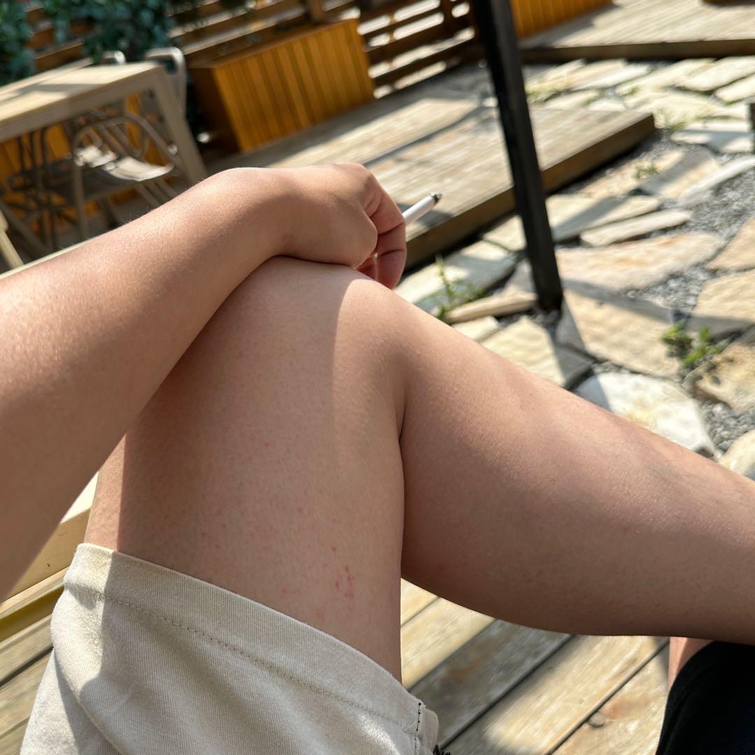 因为前女友脚臭导致现在不吃螺狮粉和猪爪