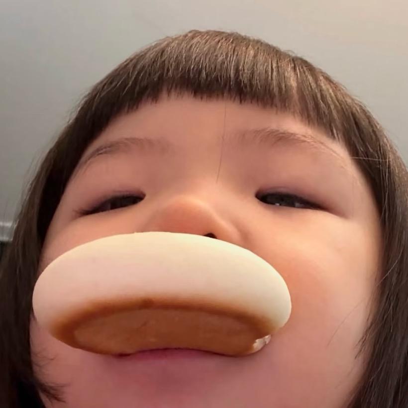 黑眼圈