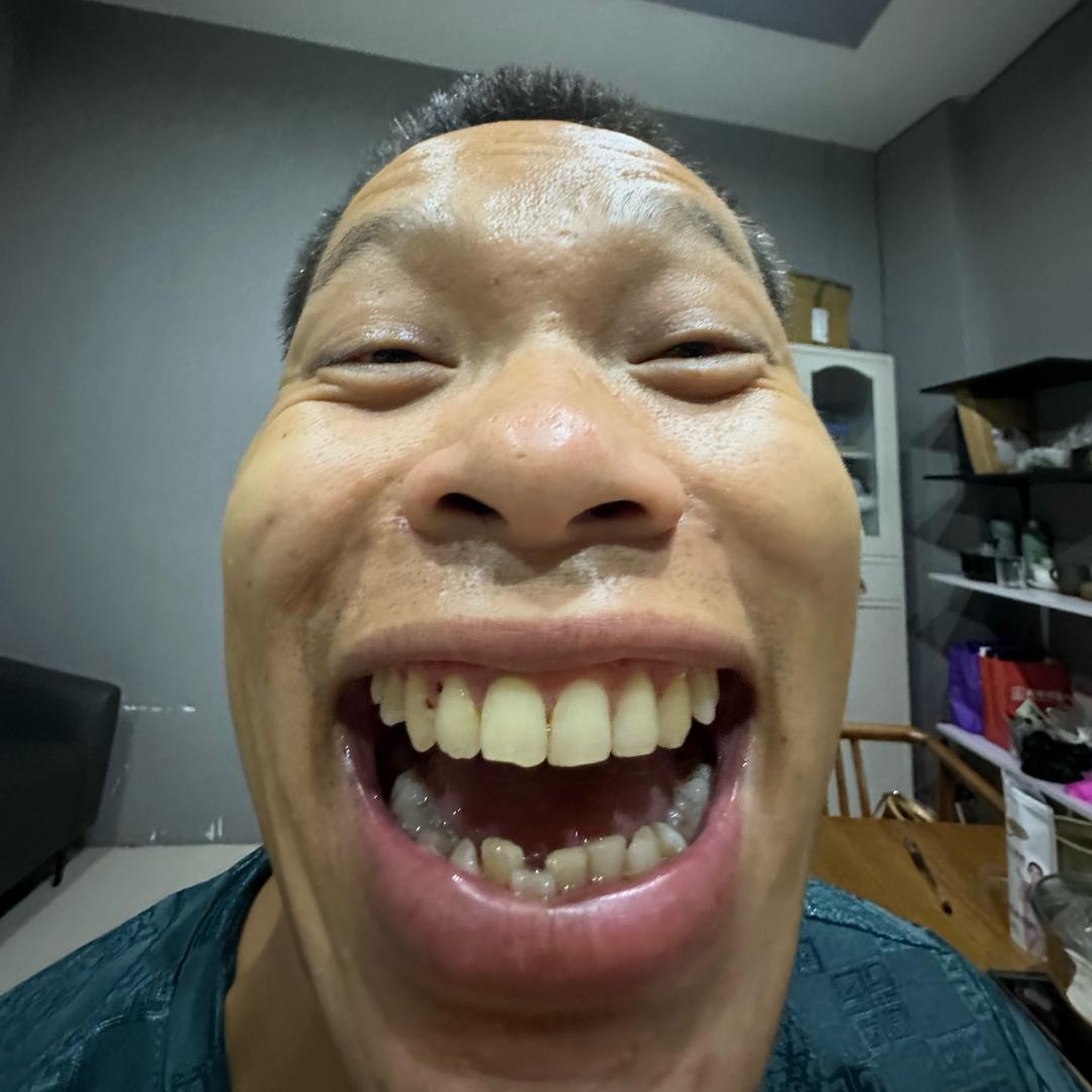 大嘴（负债上岸）