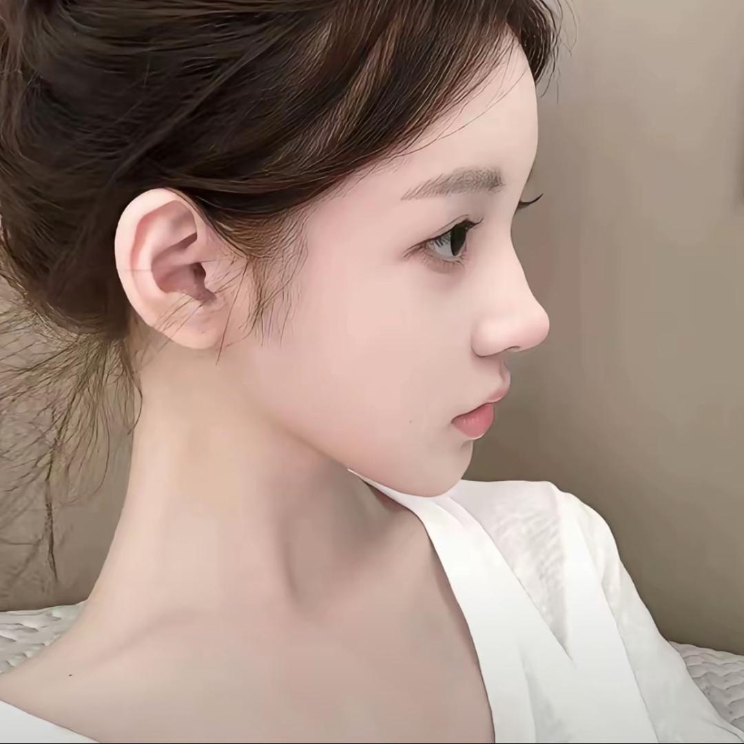 yy