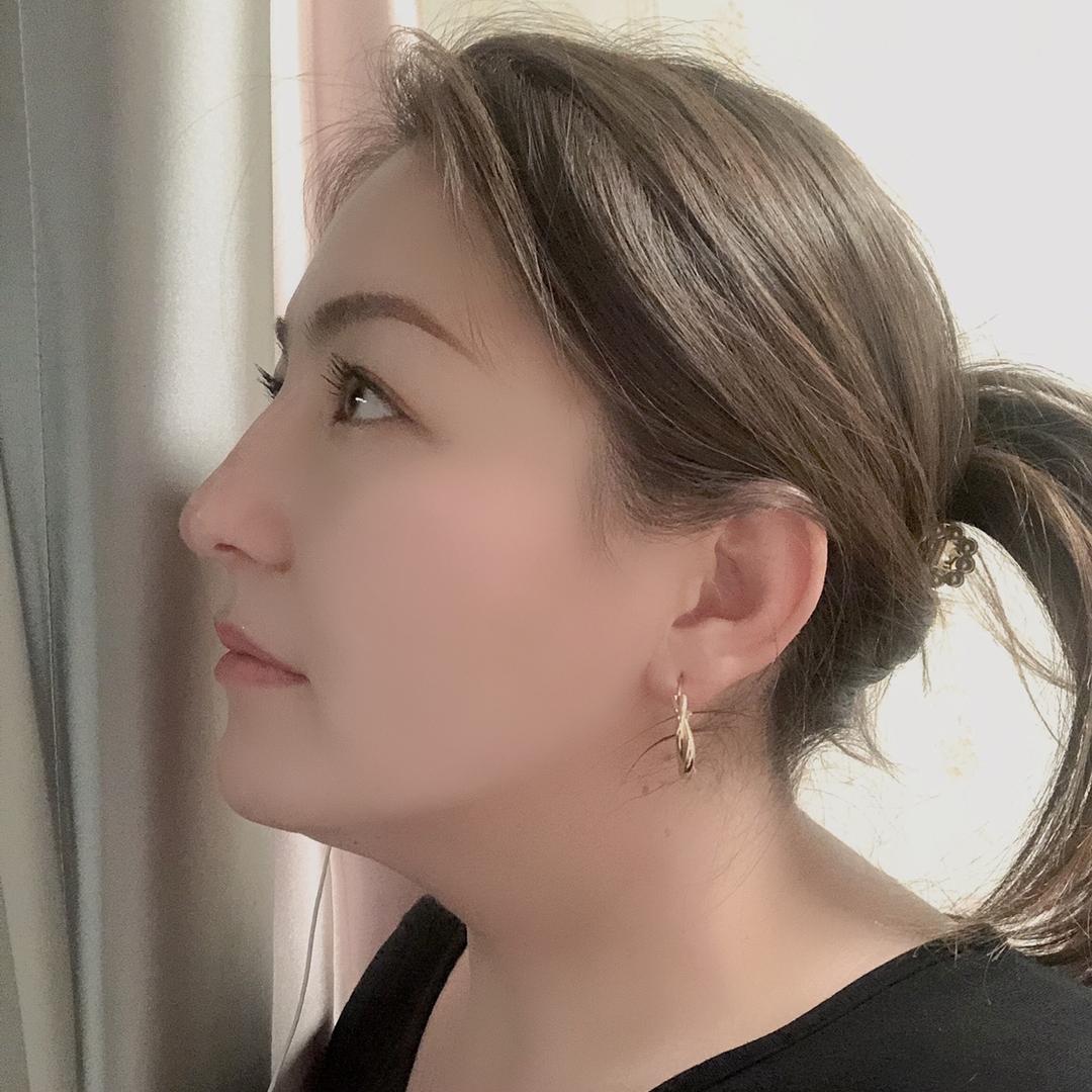 阿莱