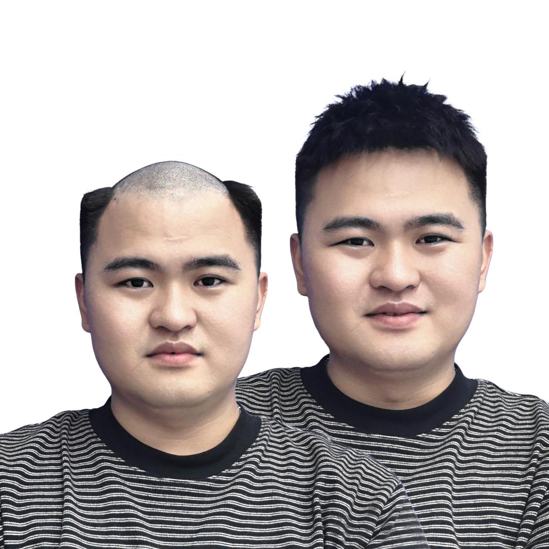 尚都男士假发定制（陆丰碣石）