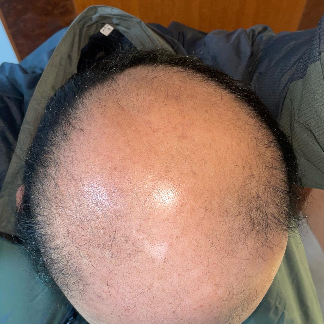 小哥生发记(七级光板上岸中)