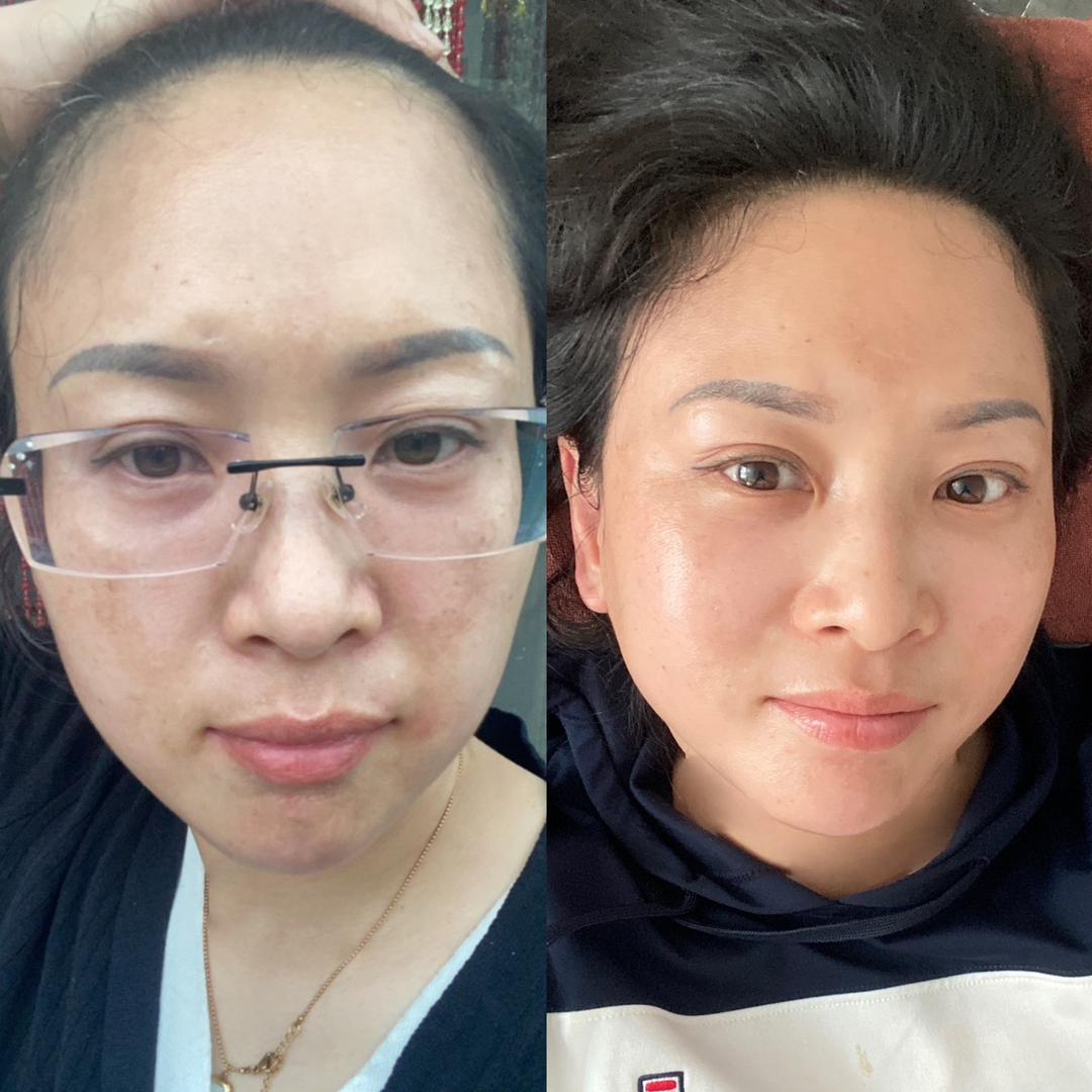德州吕老师问题性皮肤管理《十五年老店》