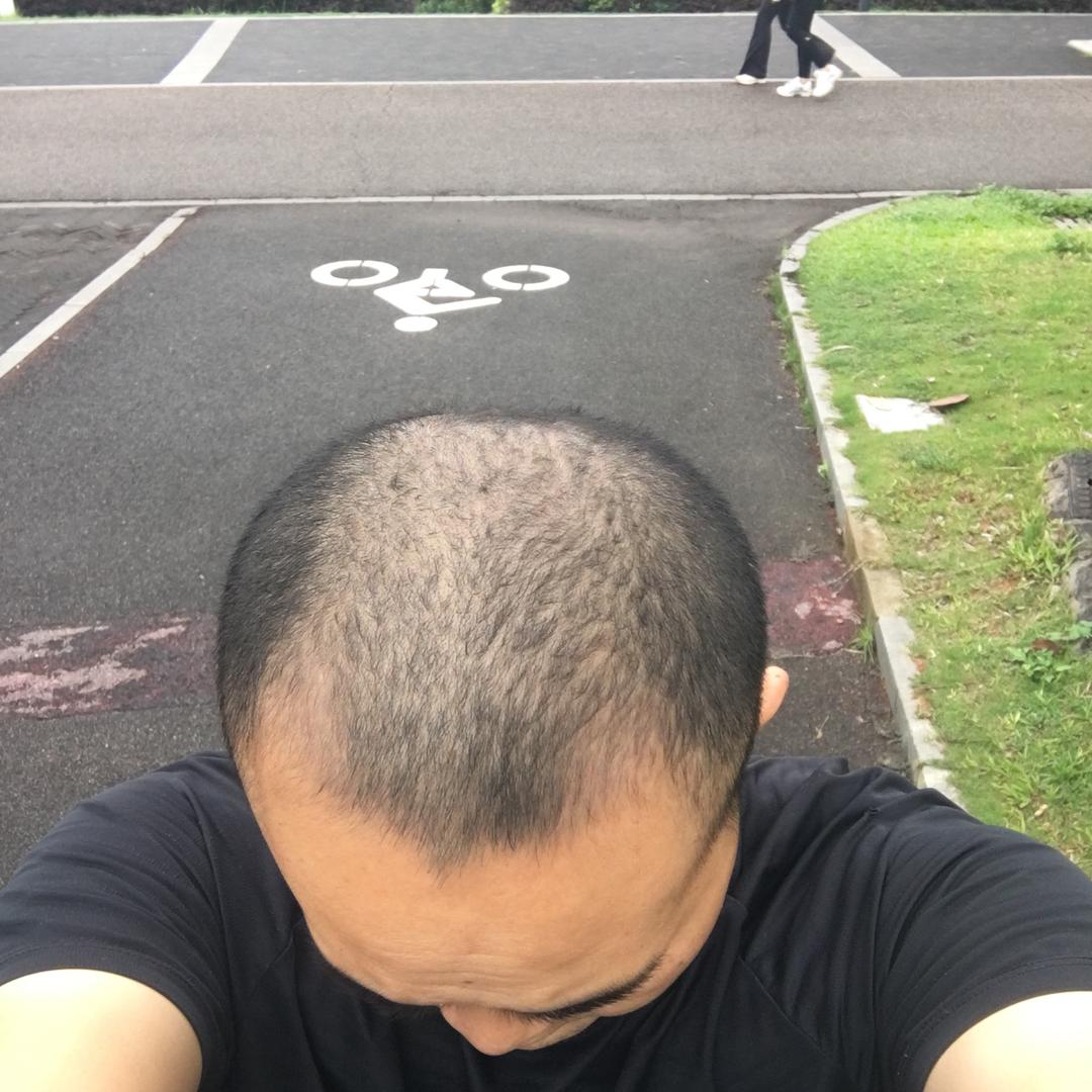 亲身实践养发
