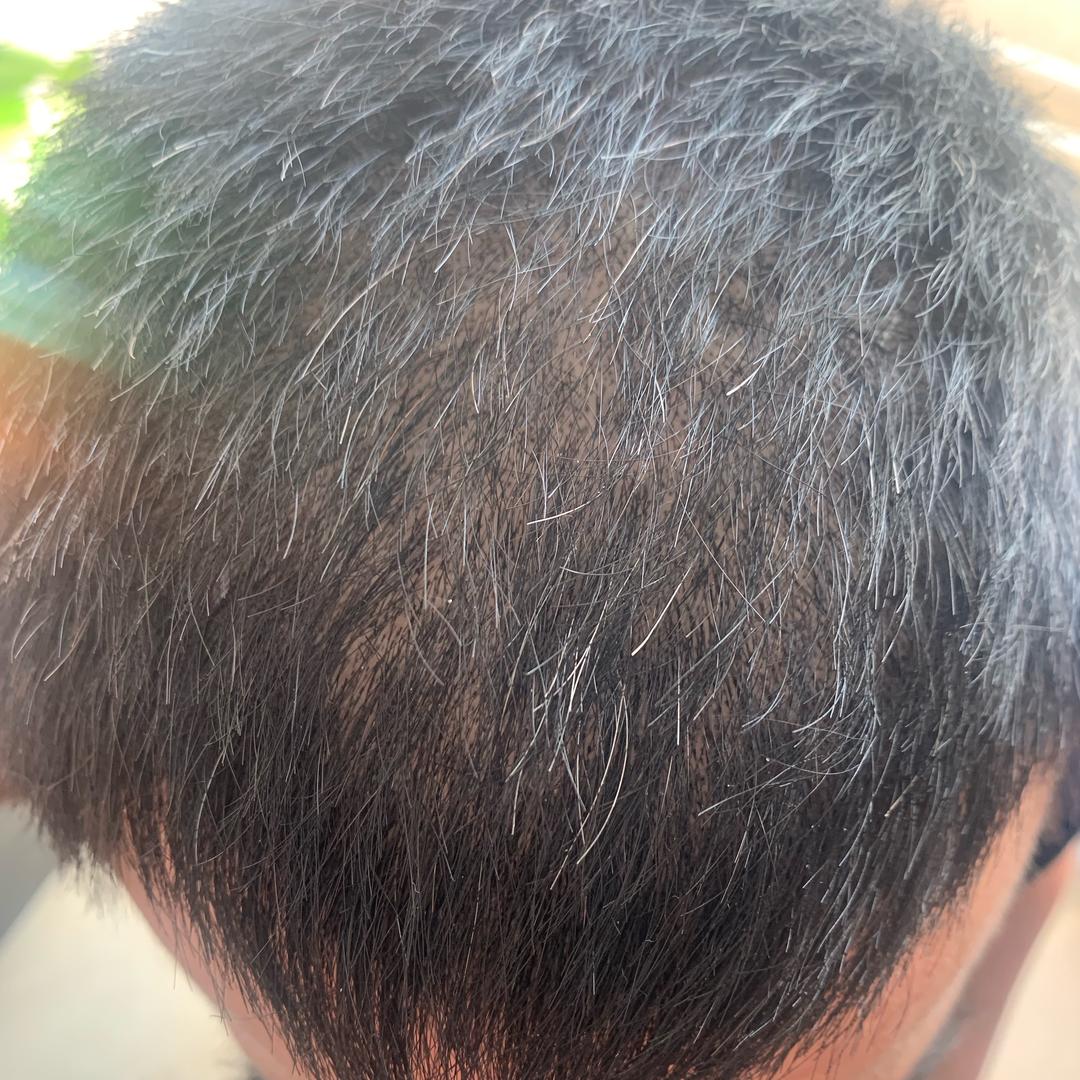小超养发