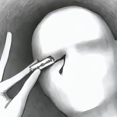 百分百