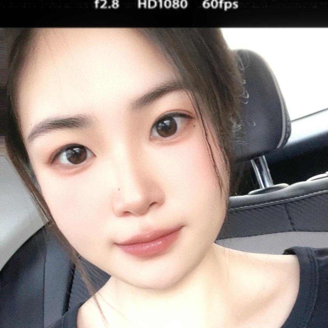 香菜过敏🤷‍♀️