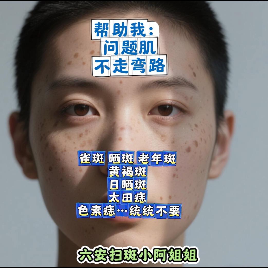 六安扫斑小阿姐