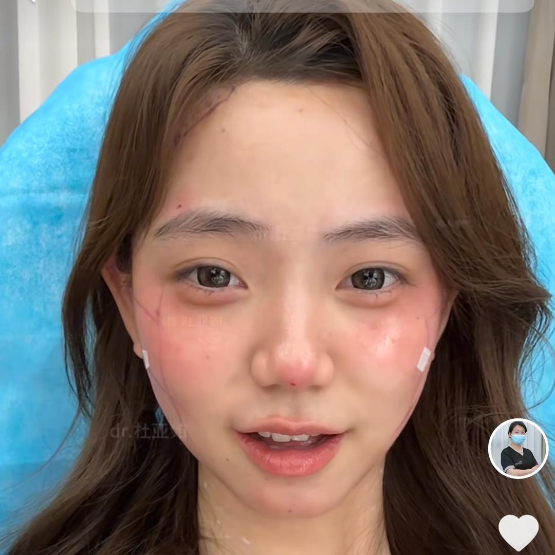 玫瑰