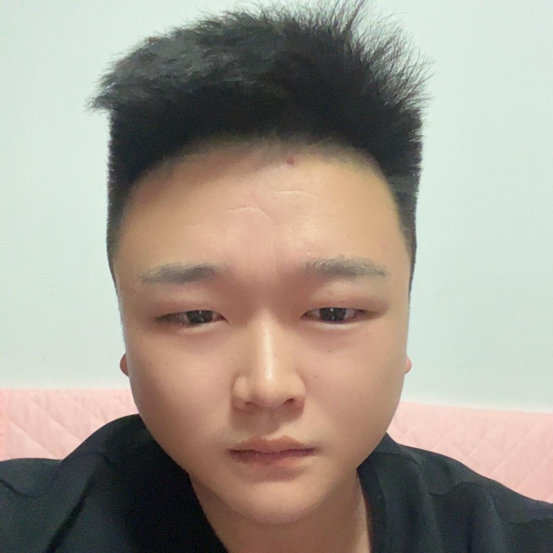 阿强
