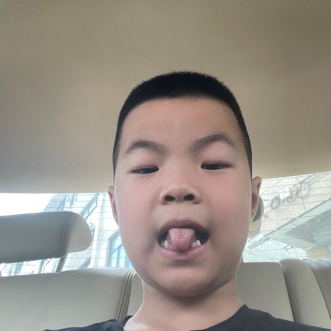 永远的凯