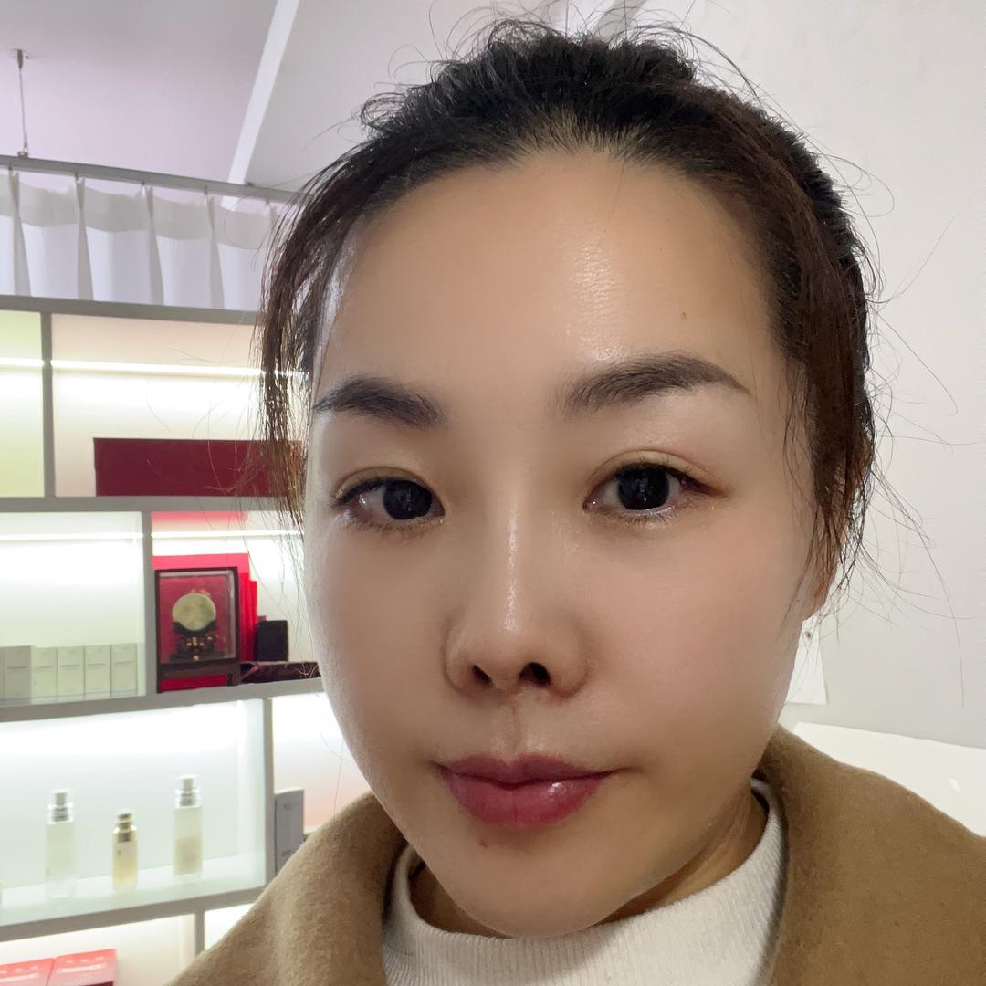 杨姐重庆二郎祛斑祛痣