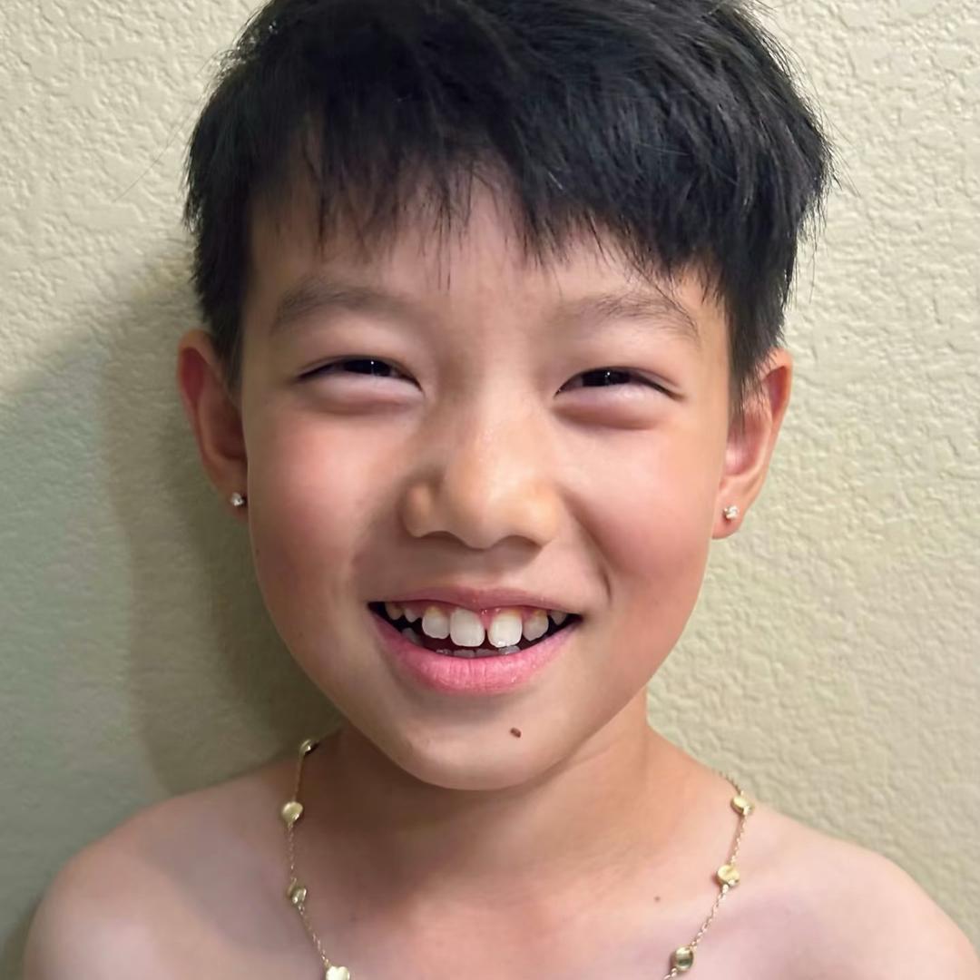 阿哥