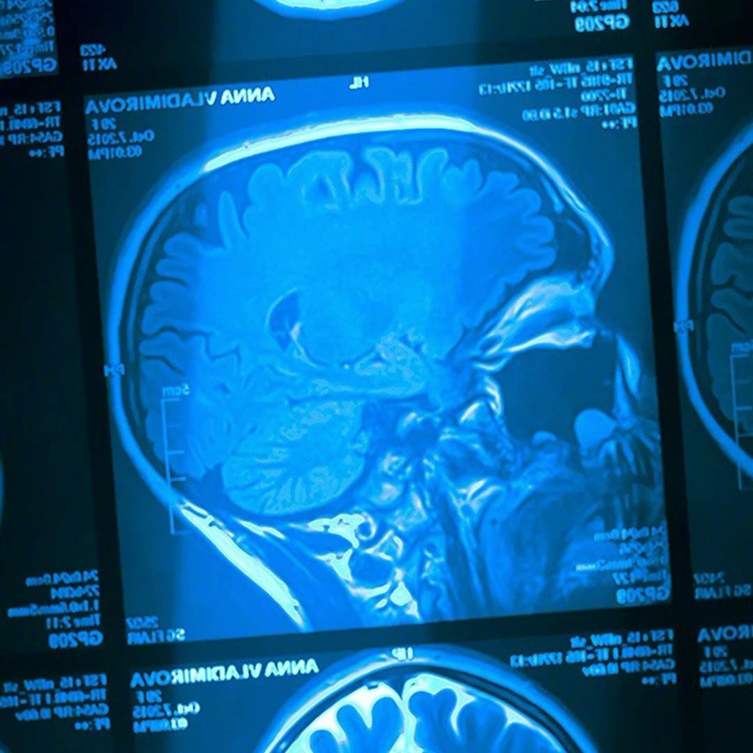 明天不喝酒Amis.