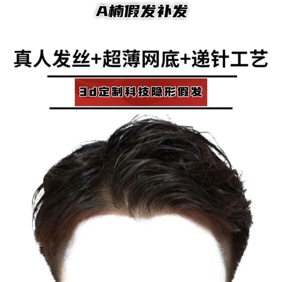 北京善润美发假发补发