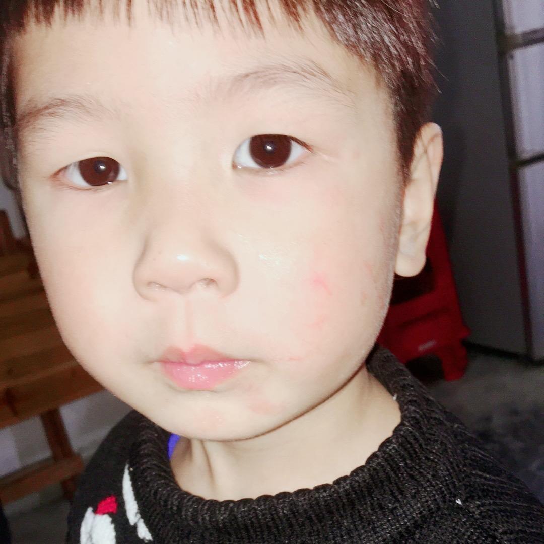馒头、