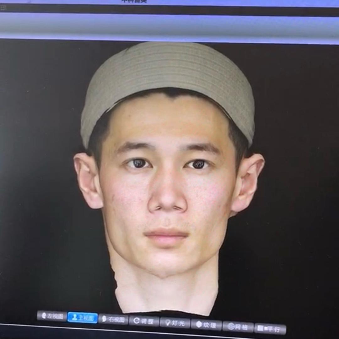 改脸型的婕希助理