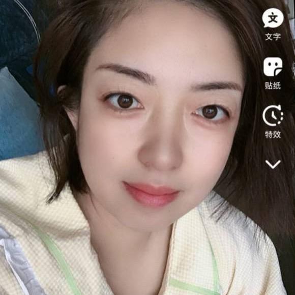 祁县阿瑞专注问题肌1