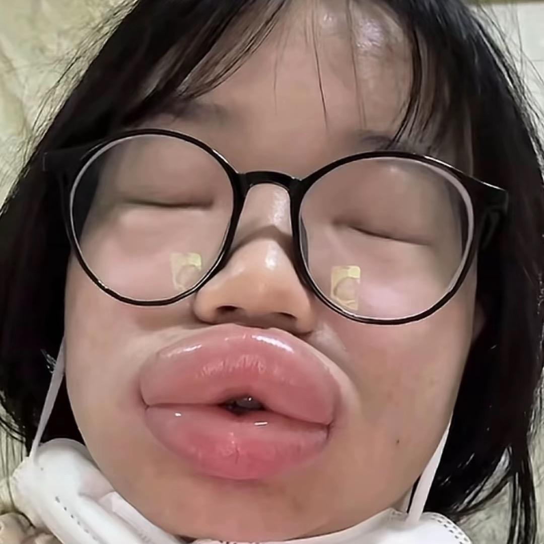 不吃蔬菜