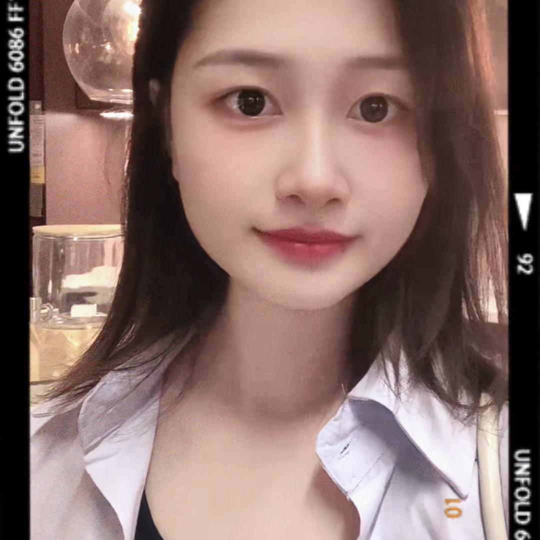 ✨小米