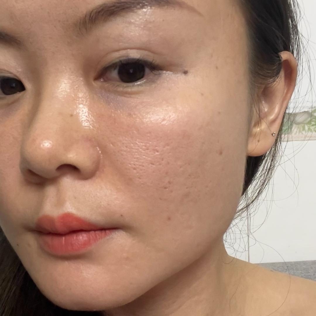 梅梅(痘坑分享版)